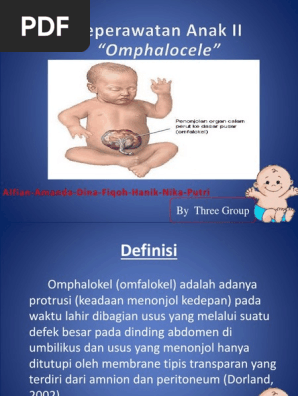 Omphalocele