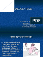 P1toracocentesis 110924215425 Phpapp02