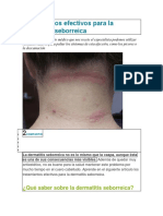 Tratamientos Efectivos para La Dermatitis Seborreica