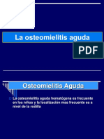 1- Osteomielitis Agudas