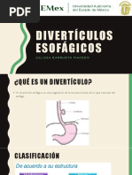 Divertículos Esofágicos