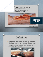 Compartment Syndrome: Zulqaidandy Rahman