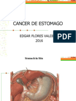 Cancer Gastrico  f