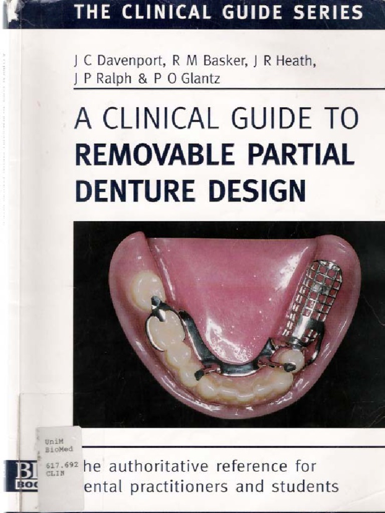 A Clinical Guide to Removable Partial Denture Design Dentures Dentist