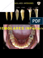 Premolares Inferiores