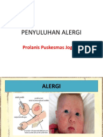 prolanis alergi