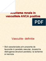 Afectarea Renala in Vasculitele ANCA Pozitive