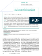 The Use of Computed Tomography in Identifying Radiologically Occult Hip Fractures in The Elderly