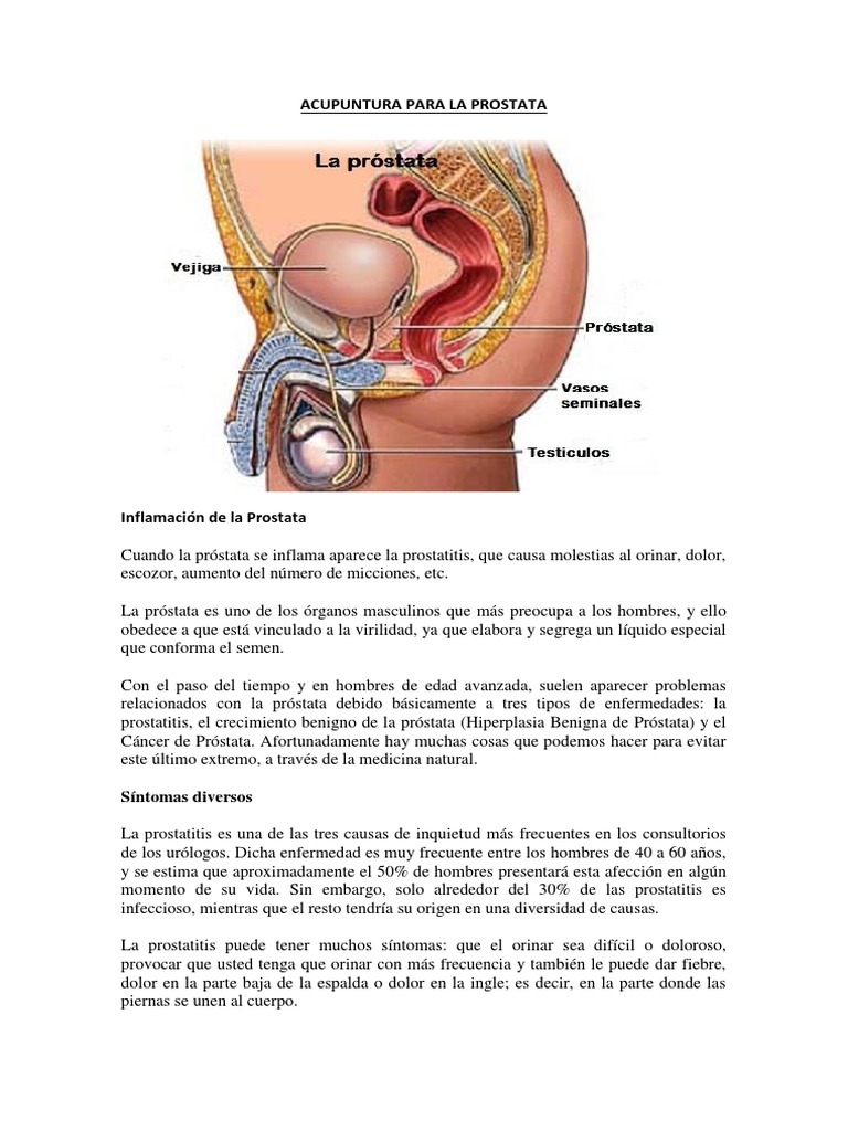 Cancer de prostata minsal Cancer de colon minsal