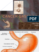 Cancer Gastrico Hns