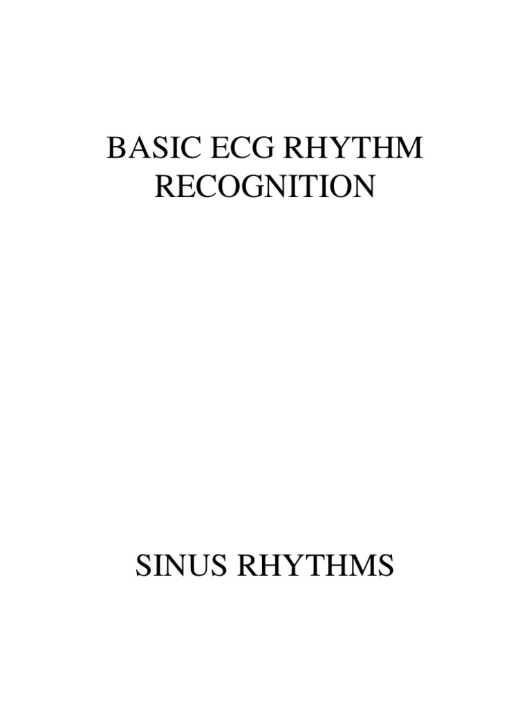 Ecg Rhythm Recognition Pdf