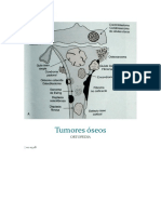 Tumores Óseos
