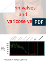 Vein Valves and Varicose Veins