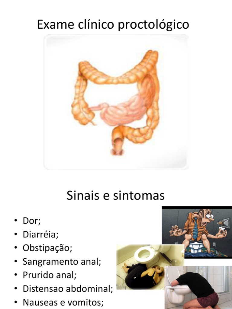Exame Proctológico Pdf Prisão De Ventre Hemorroida