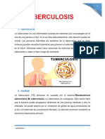 TUBERCULOSIS.docx