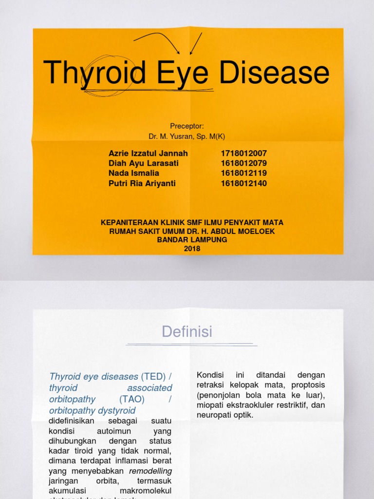 Thyroid Eye Disease (TED) | PDF
