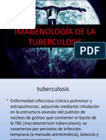 Radiologadelatuberculosis 101024143231 Phpapp02