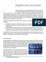 Diagnóstico Radiográfico de La Caries Dental