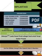 Radioterapi Implantasi