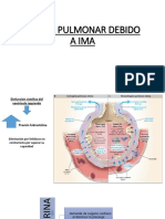 Edema Pulmonar Cardiogéno