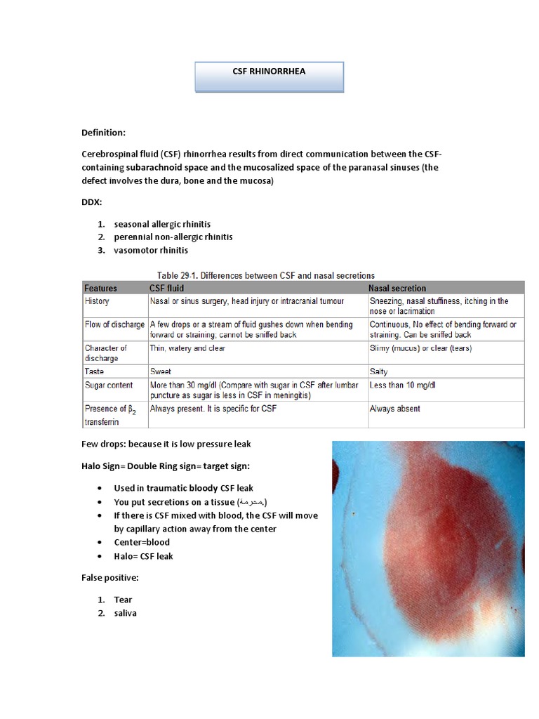 CSF Rhinorrhea | PDF | Cerebrospinal Fluid | Meningitis