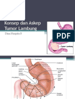 Konsep Dan Askep Tumor Gaster