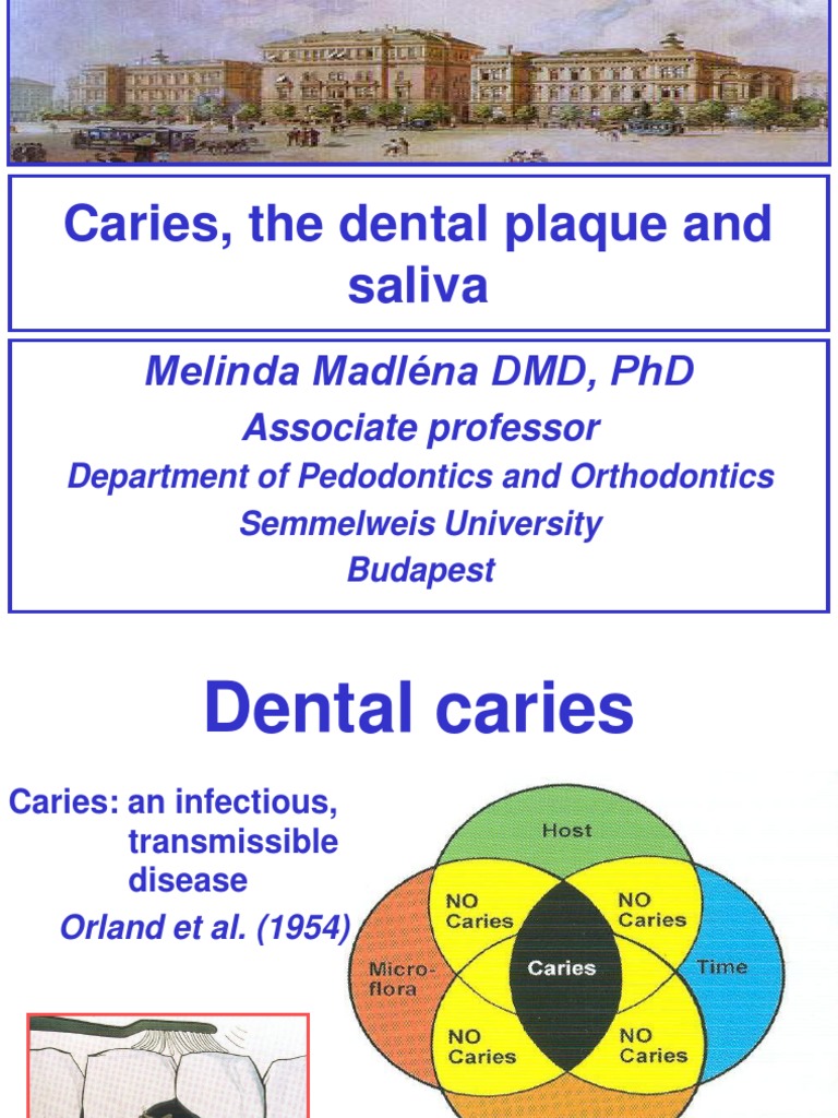 Caries The Dental Plaque and Saliva PDF Oral Hygiene Saliva