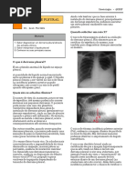 Derrame Pleural.pdf