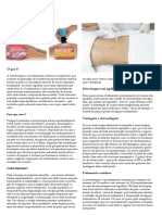 Mesoterapia PDF