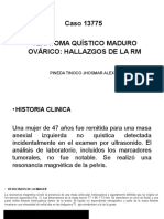 Teratoma Ovarico Quistico Maduro