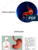 Ulcera Péptica