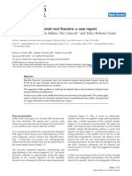 Treatment of horizontal root fracture.pdf