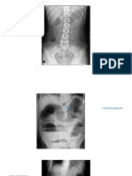 Presentation Abdomnal X Ray