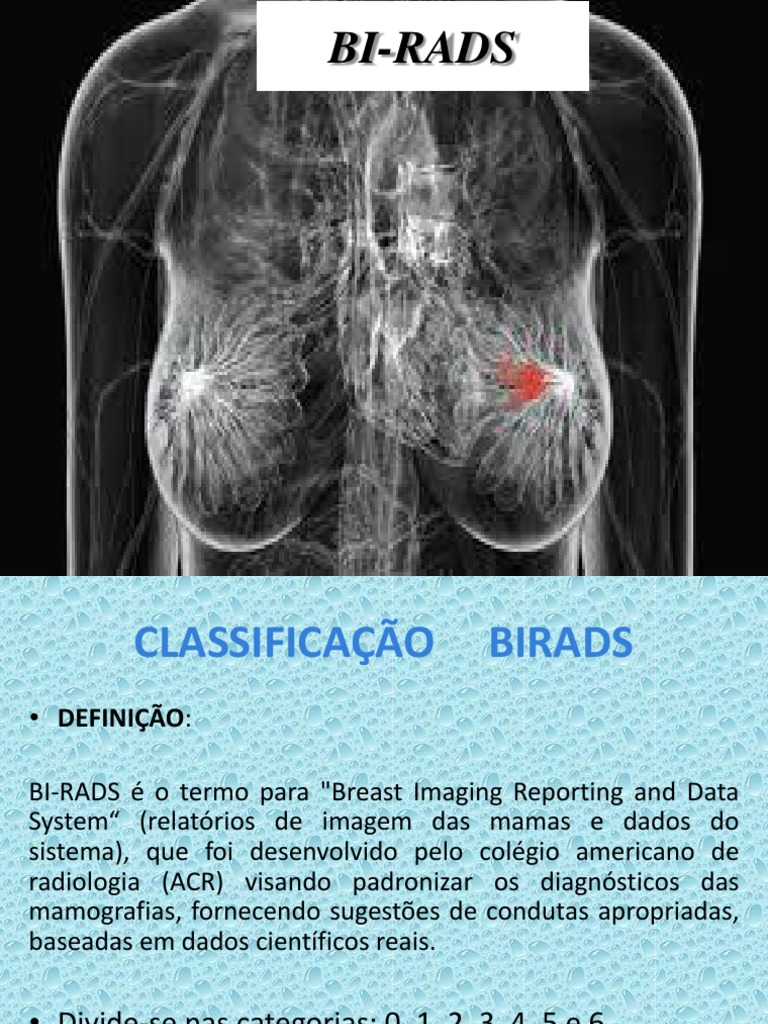 BI-RADS: classificação e condutas para mamografia | PDF | Câncer de ...