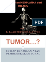 Tumor tulang