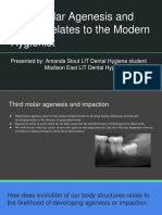 Third Molar Agenesis and How It Relates To The Modern Hygienist