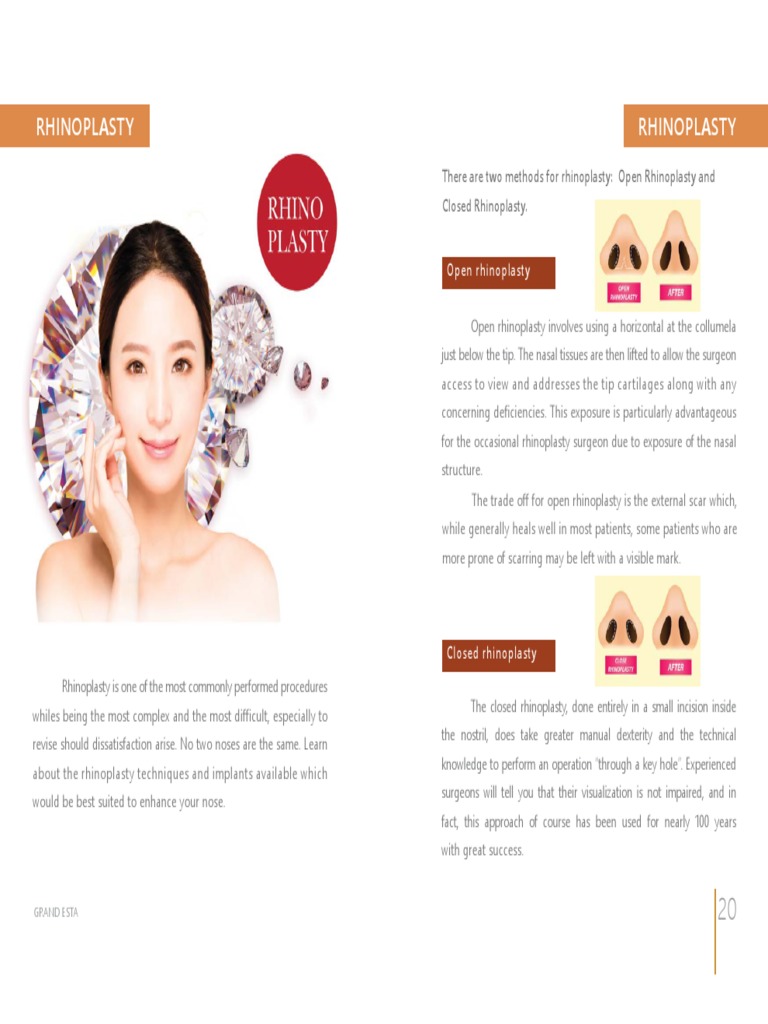 Rhinoplasty Techniques Explained | PDF | Face | Surgery