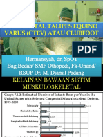 Clubfoot Congenital Talipes Equinovarus Ctev Kaki Pengkor PDF