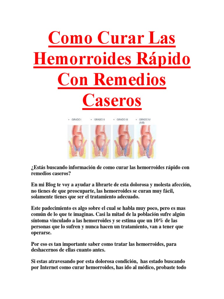 Never Suffer Again! The Ultimate Guide To **Remedios Caseros Para Las Hemorroides** (You Need This!) - zo1re30