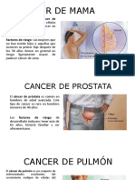 Tipos de Cancer MAS COMUNES