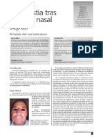 3 - Rinoplastia PDF