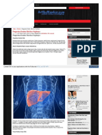 WWW Artikelkanker Com Pengertian Kanker Hati Dan Gejalanya PDF