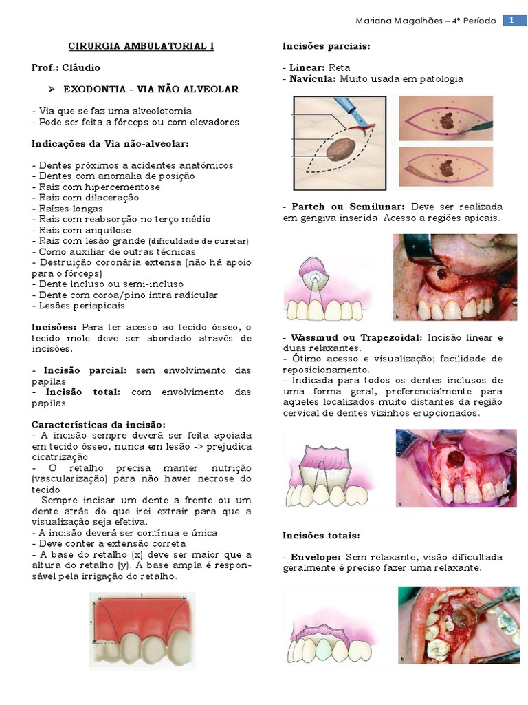 Cláudio Resumo de Exodontia - Nao Alveolar | Dente | Ciências da Saúde