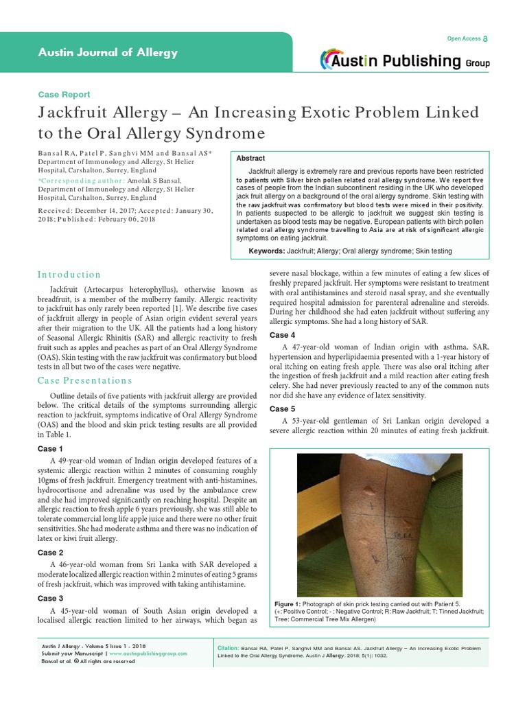 Austin Journal of Allergy PDF Allergy Allergen