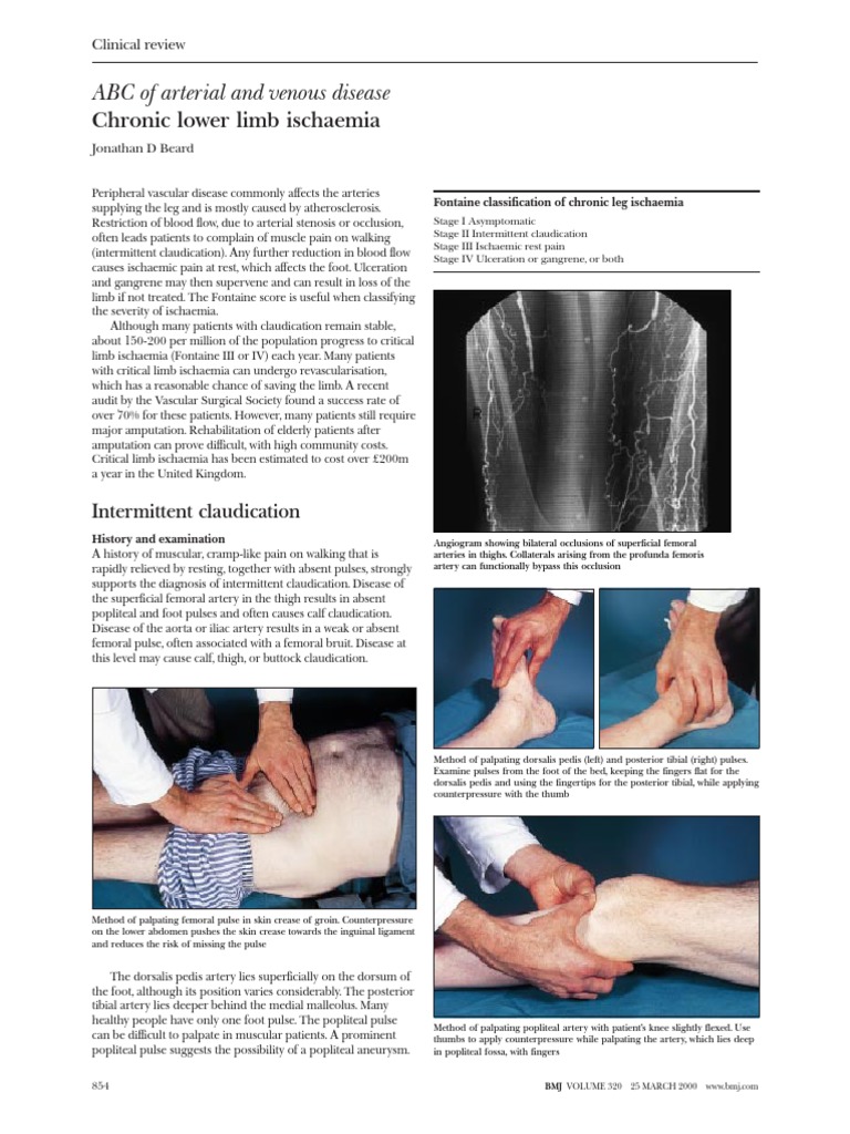 Peripheral Arterial Disease: Classification, Diagnosis, and Treatment ...