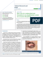 Rare Case of A Conjunctival Cyst Formation in An Anophthalmic Socket of A 10 Years Old Patient