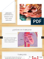 Tabique Inter y Ventricular