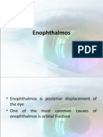 Enophthalmos