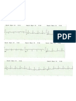 Electrocardiograma_Generalidades
