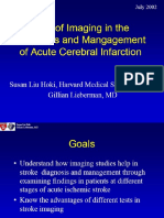 angle closure acute glaucoma